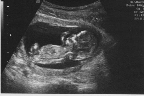 Muswada Chapter Chapitre 12 Le Bebe